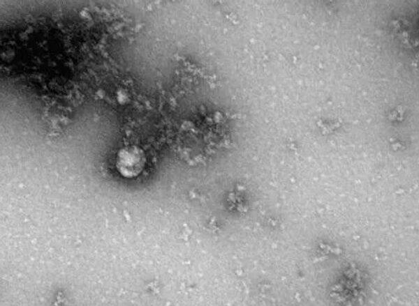 Фото нового штамма коронавируса