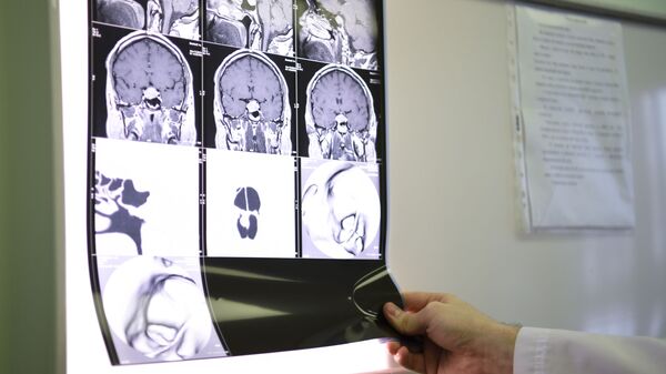 Медицинский работник смотрит снимки пациента помещенного в модернизированный аппарат Гамма-нож
