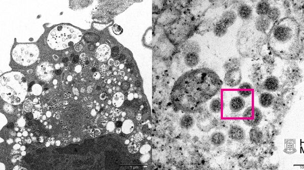 Университет Гонконга опубликовал изображение варианта коронавируса омикрон, полученное при помощи электронного микроскопа