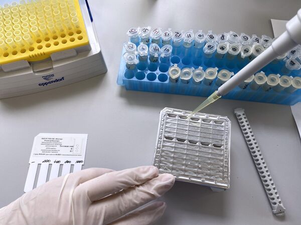 Тест-система