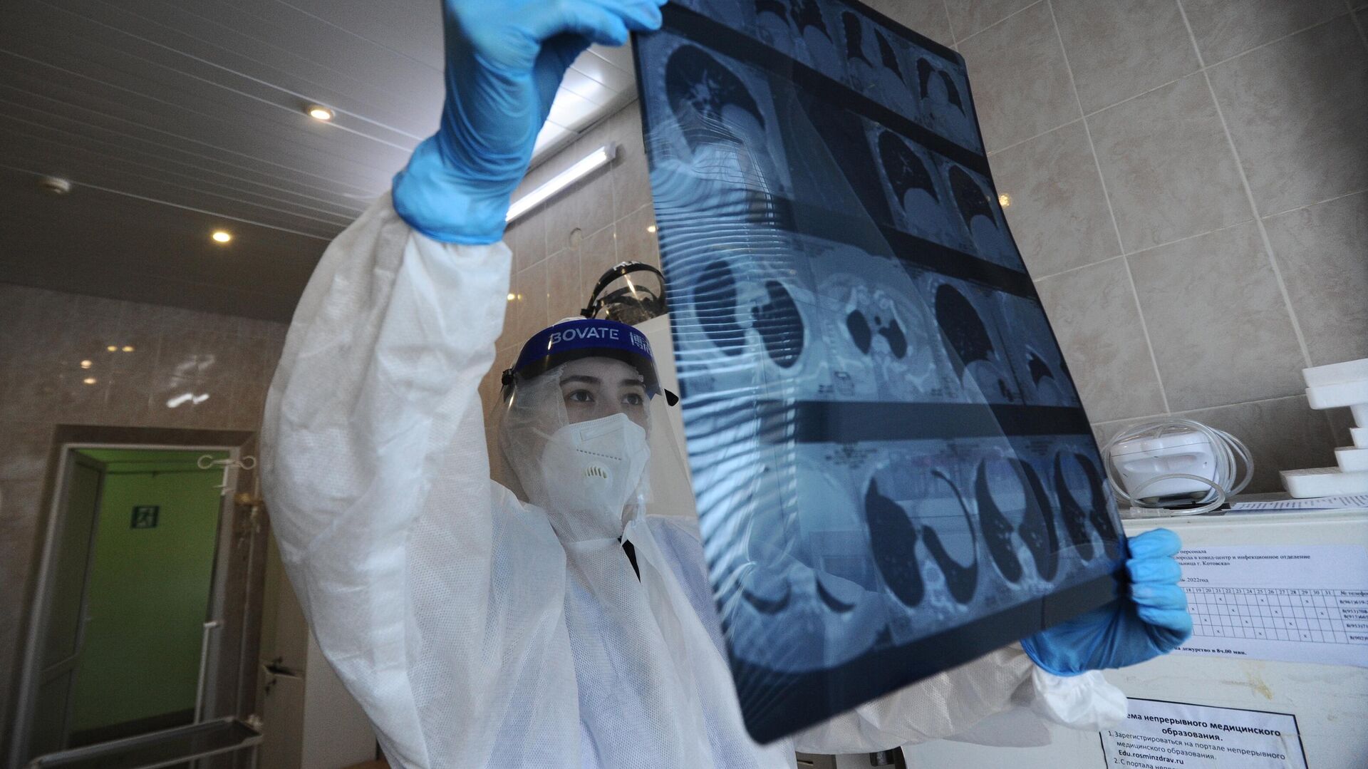 Медицинский работник изучает результат компьютерной томографии органов грудной клетки - РИА Новости, 1920, 07.02.2023