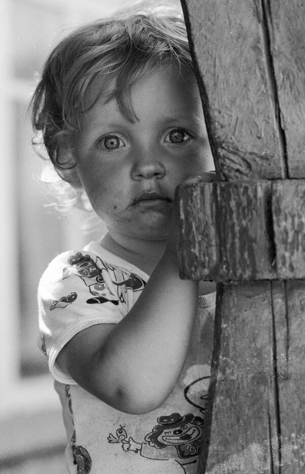 Ребенок из деревни Чудяны, пораженной радиацией в результате аварии на Чернобыльской АЭС
