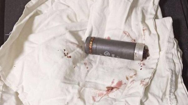 В Донецке врачи и пиротехники извлекли из тела раненого военнослужащего осколок гранаты