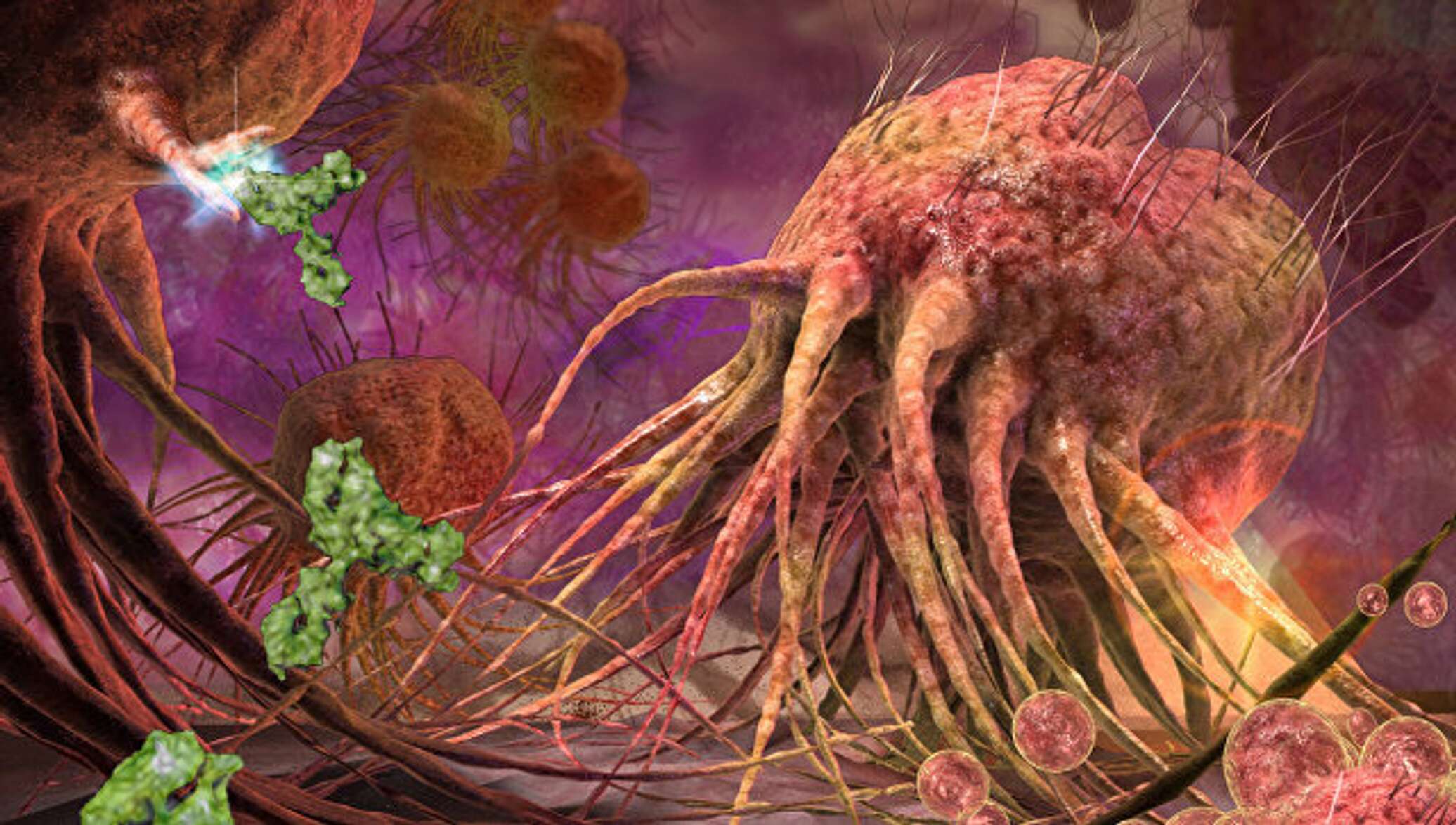 Кармический рак. Картина злокачественной опухоли. Раковые клетки под микроскопом.