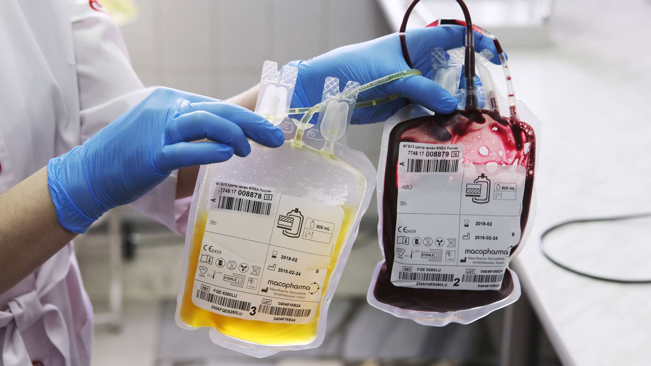 Препарат донор. Плазма крови. Переливание плазмы крови. Перелив плазмы крови. Компоненты крови для переливания.
